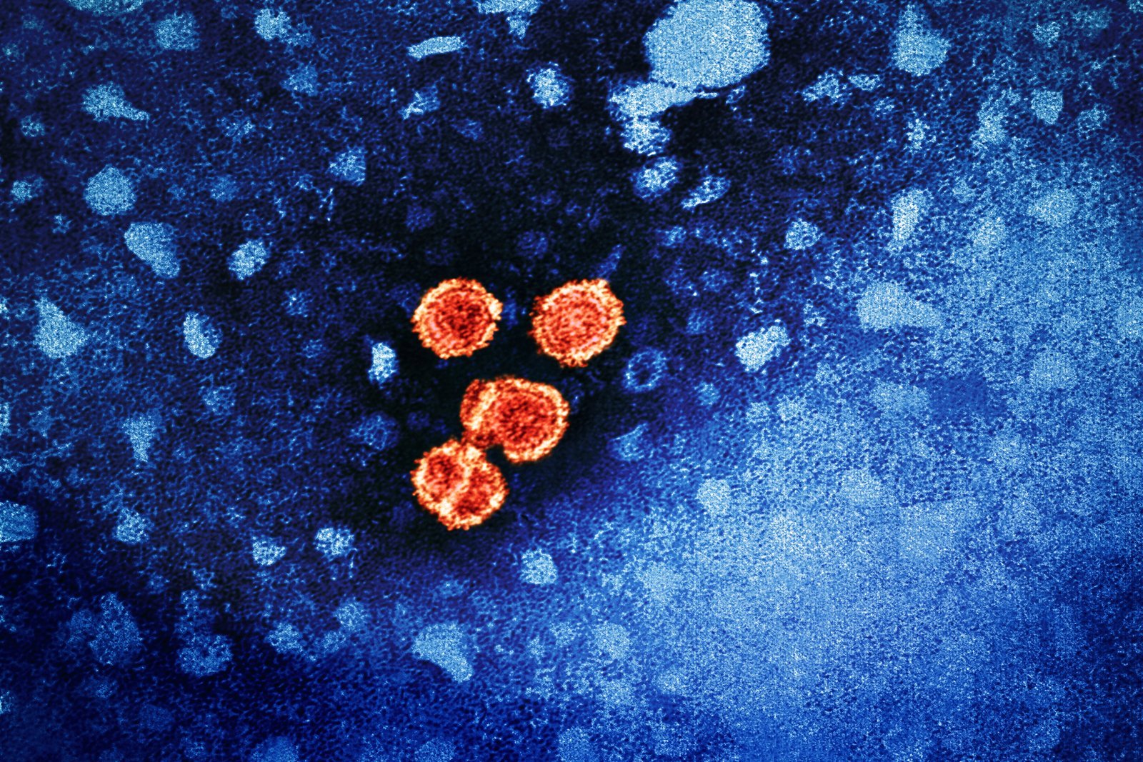 FDA approves GSK and Ionis hepatitis B drug offering potential functional cure