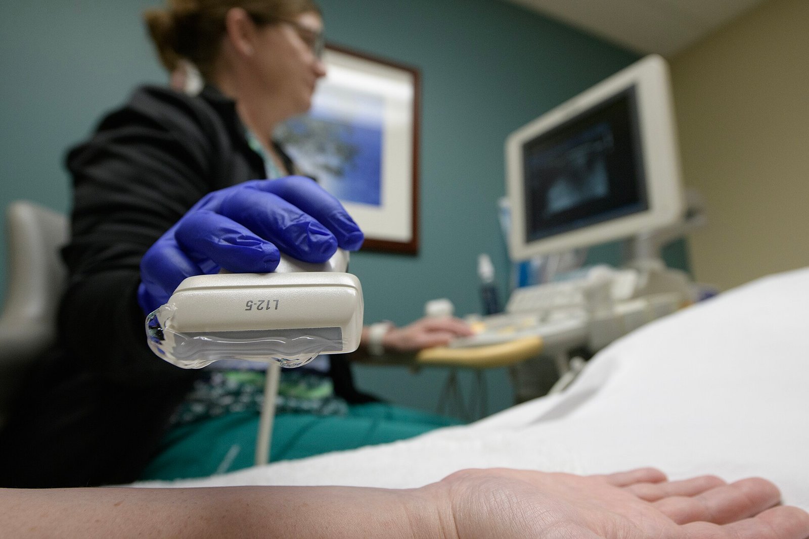 AI puts the ultrasound probe in more hands as histotripsy reaches a $3.75bn valuation